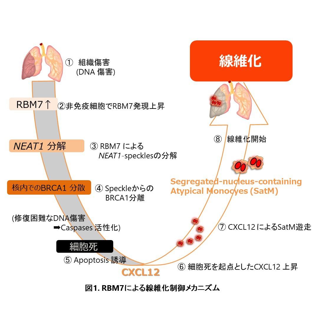 難病 線維症の発症原理 を解明