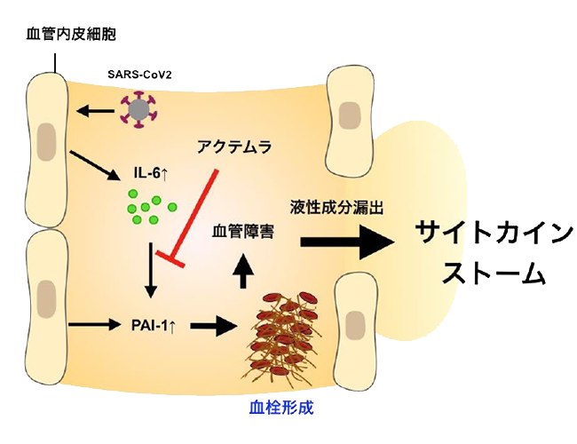 コロナ 血管 炎症